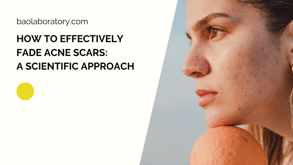 Acne Scars